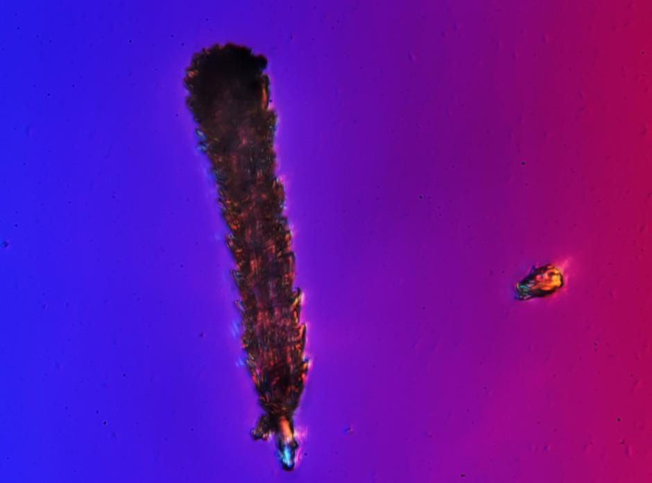 北京霾颗粒在显微镜下放大1000倍 竟是这个样