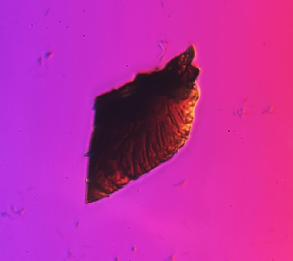 北京霾颗粒在显微镜下放大1000倍竟是这个样