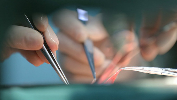 人体器官,分配共享,儿童患儿