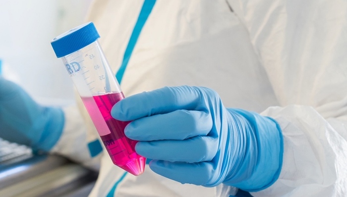 如何阻击艾滋病新诊断感染者病死率?