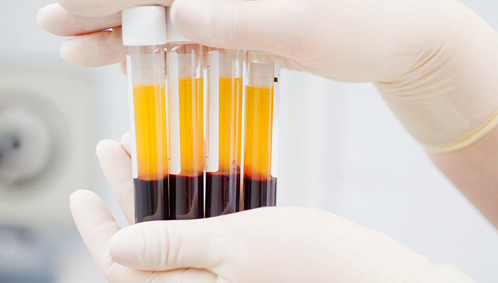 新冠肺炎康复者血浆内抗体可用于治疗,其原理是什么?