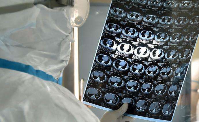 谁在满足暴增的CT机需求?