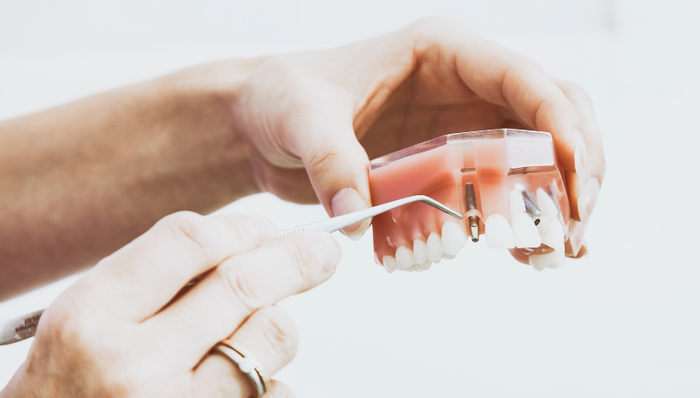 牙齿正畸,时代天使