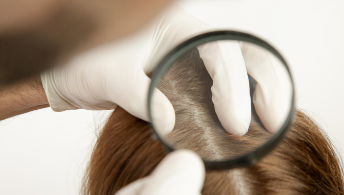 植发,脱发经济,营销,扩张