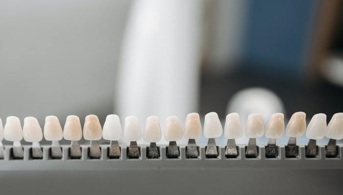 種植牙,降價,市場需求