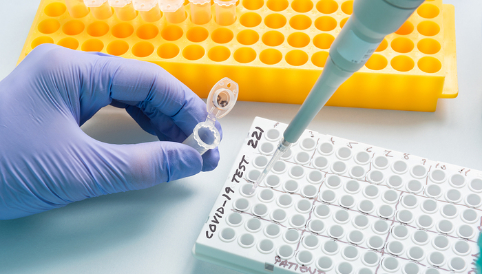 上海,疫情,核酸,之江生物,上海制造