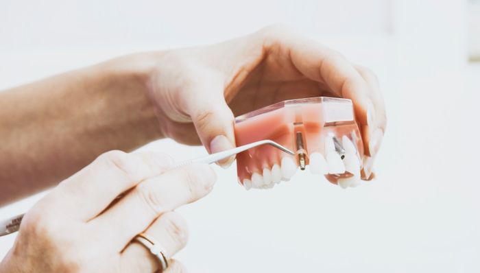 顏值經(jīng)濟(jì),正畸,年輕人