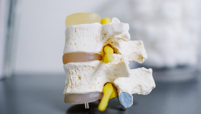 人工关节,集采,医保,中标