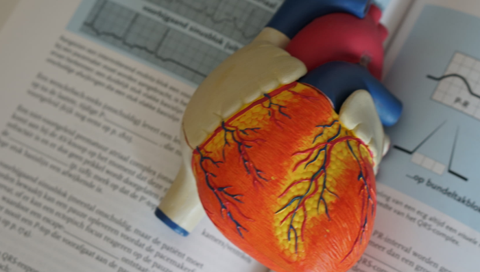 TAVR,心脏瓣膜,上市公司
