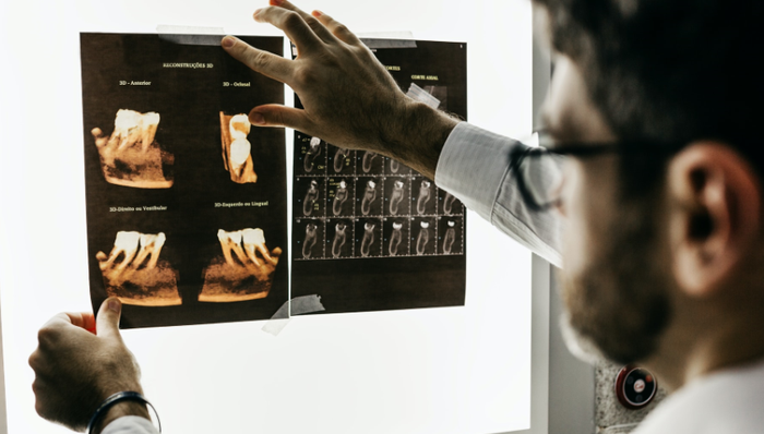 醫(yī)學(xué)影像,投資,掌上超聲