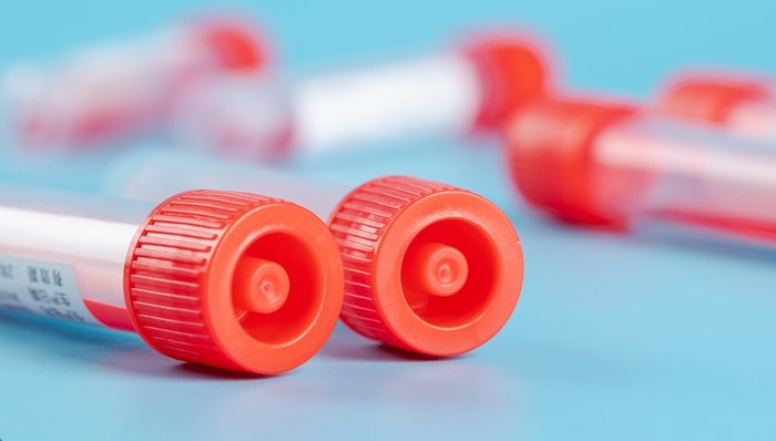 熱點(diǎn)關(guān)注