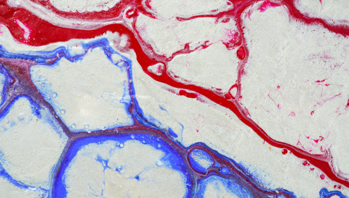 默沙東,收購,靶向藥物,血液學(xué)