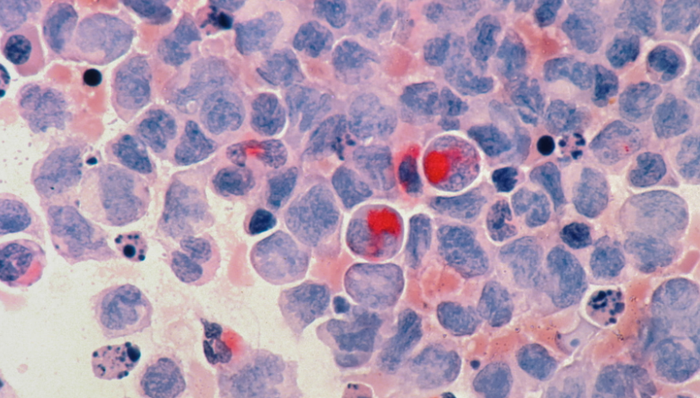 創(chuàng)新藥,藥物研發(fā),慢性病,中國(guó)市場(chǎng)