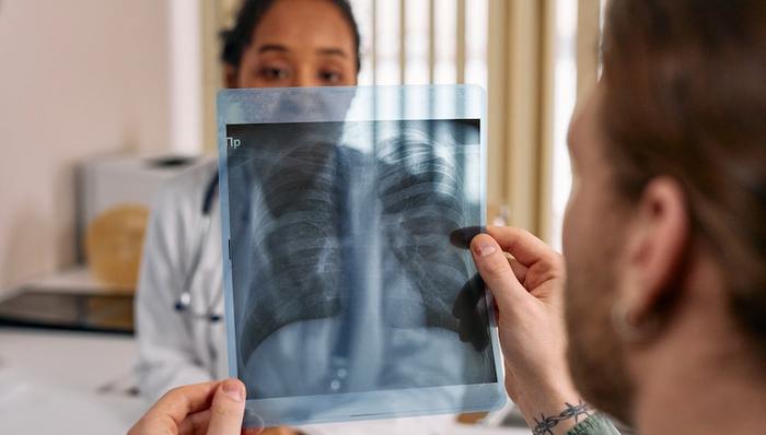 數(shù)字醫(yī)療,Butterfly,上市公司,