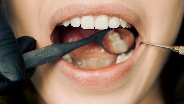 医学影像,CT,产品创新,差异化,