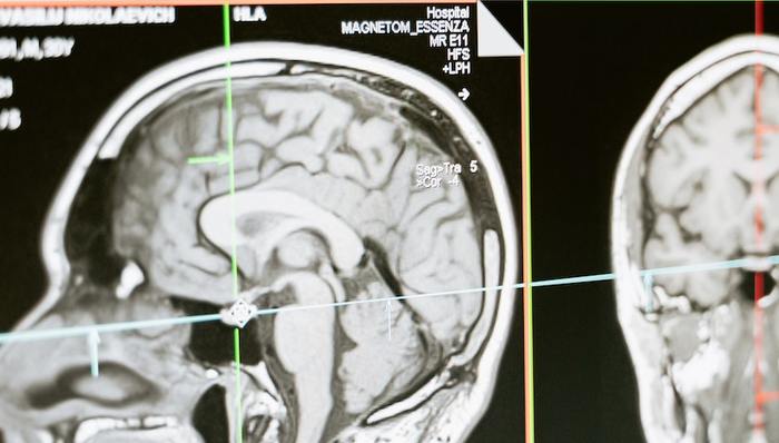 內(nèi)窺鏡,醫(yī)學影像,奧斯巴林,