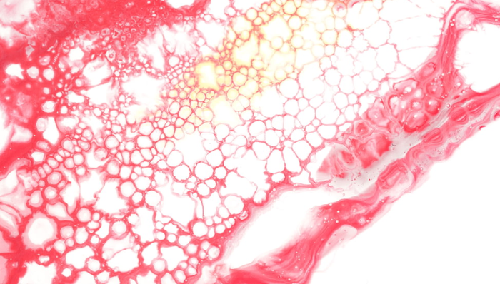 醫(yī)療創(chuàng)新,投資,醫(yī)療器械,