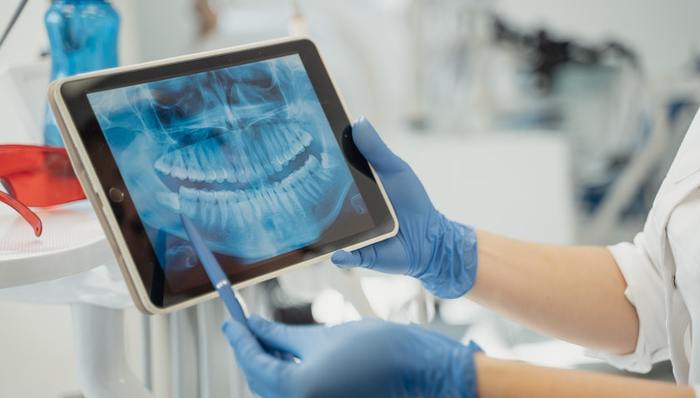 內(nèi)窺鏡,國產(chǎn)品牌,本土化,