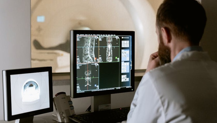 集中采購,骨科耗材,行業(yè)趨勢,國產(chǎn)品牌,