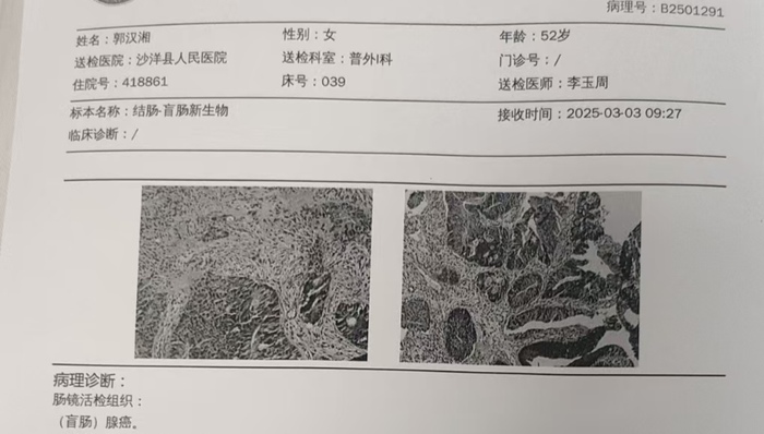 重疾下的失独再生养家庭困境待解,基层卫健局:政策“宜早不宜迟”