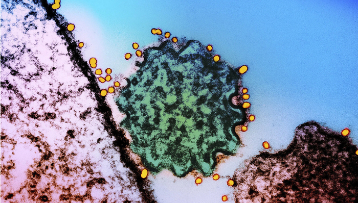 印度尼帕病毒疫情帶飛個(gè)股，專家稱傳播性相對(duì)有限