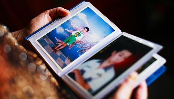 复旦投毒案,杀人动机,乙型病毒性肝炎,死因