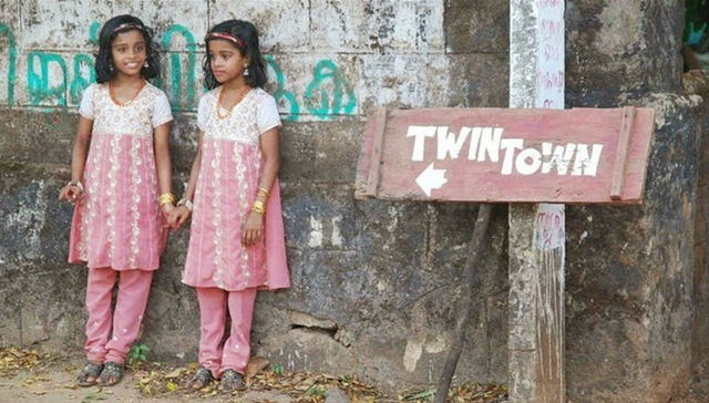 双胞胎,,遗传,,近亲