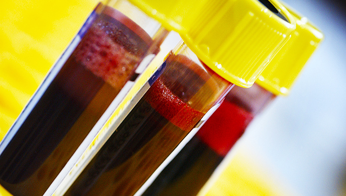 中国脐带血库成为3家上市公司争夺的目标