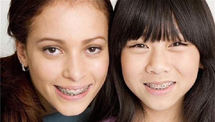 瑞尔知道，稳固长久的牙齿矫正才是家长们想要的！