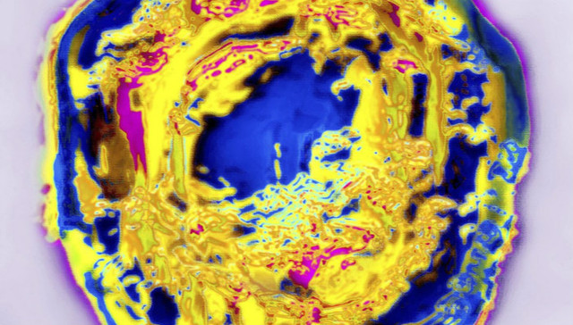 全球37亿人被这种病毒感染 为什么却没人想去治愈它？