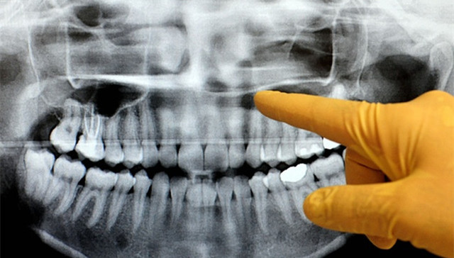 美国,英国,口腔卫生