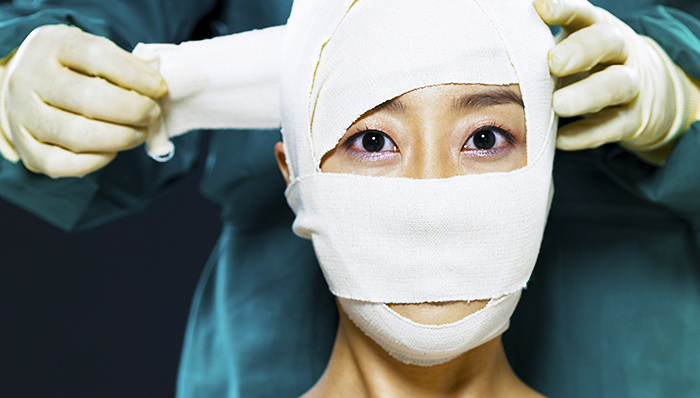 微整形整容,玻尿酸整容