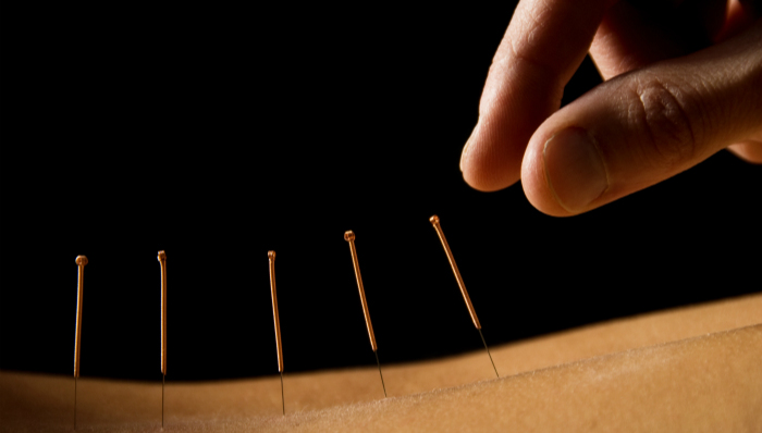 中医,中药,针灸,林超岱