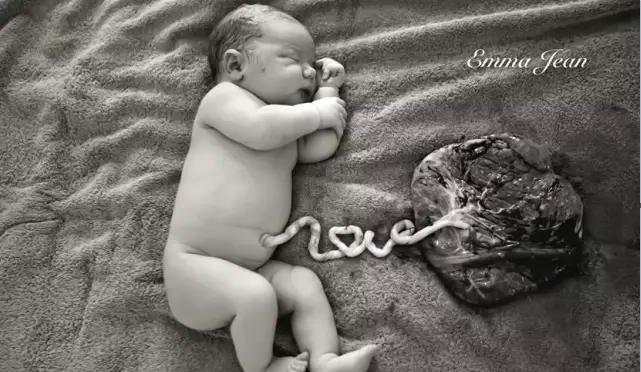 婴儿,脐带,摄影