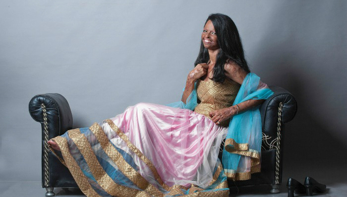 印度,硫酸,毁容,模特,公益,勇敢