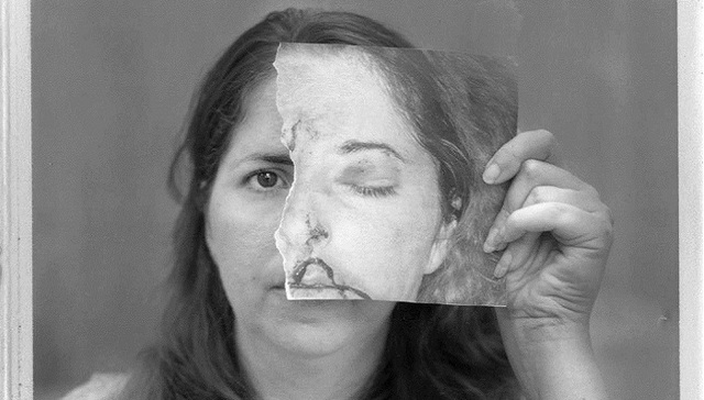 【2016普利策调查性报道奖】狂乱、危险而隐秘：佛罗里达州精神病院里的暴力现象