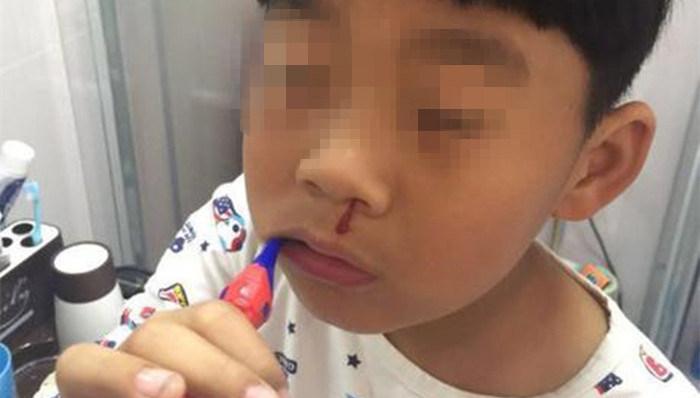 江苏,学生,鼻血,化工厂