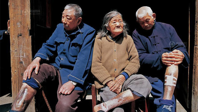 侵华日军、细菌战