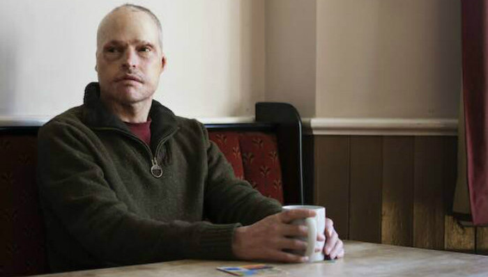 伤痕,疤痕,死神