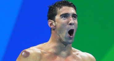 中国手艺红遍全球 美国运动员集体爱上了拔火罐