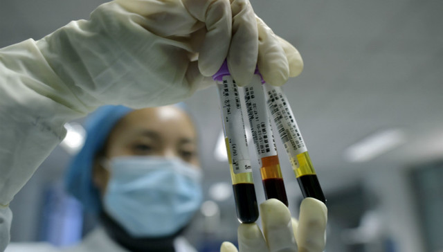 青岛9名患者感染乙肝病毒 涉事医院院长等多人被免职