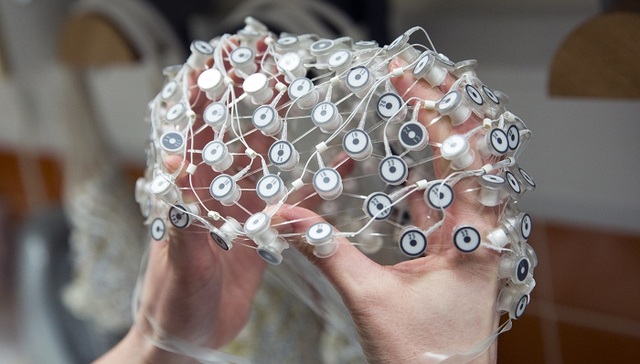 大脑活动,死亡,加拿大,δ波