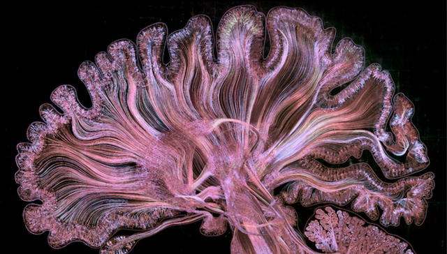 把大脑放到显微镜下，居然这么美