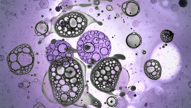 三胞集团最终拿下了那家美国生物医药公司 细胞免疫治疗药物有望在华上市了