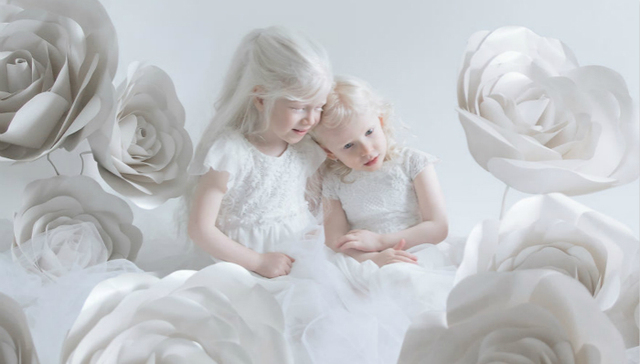 白化病人也很美