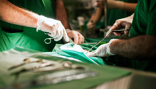 活猪,科学家,异种器官移植,内源性,中美,逆转录病毒,活性,核移植,George,免疫排斥