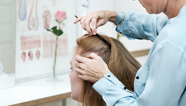 治秃顶不能光靠生发水和特技了 这家丹麦毛发诊所有一套正确打开方式