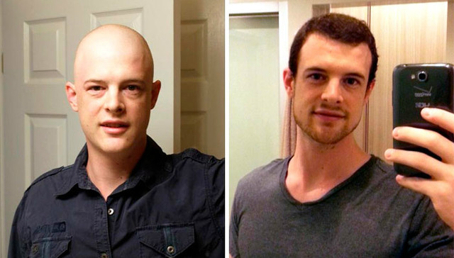 他们战胜了癌症，他们是勇士