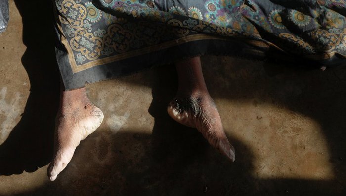 缅甸,罗兴亚人,难民危机