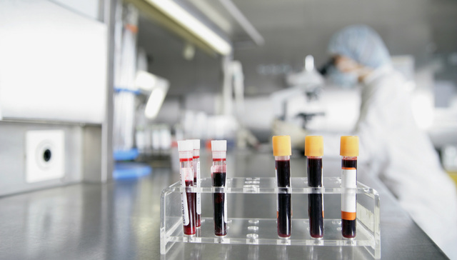 澳洲医药想成为中国最大血浆采集商  当然还得让中国人愿意献血